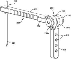 Chevron osteotomy tools and methods