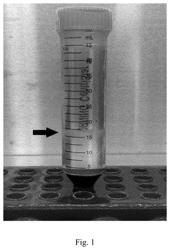 Uses of induced neural stem cells derived from peripheral blood mononuclear cells