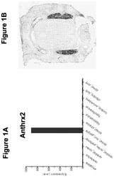 Compositions and methods for treatment of pain