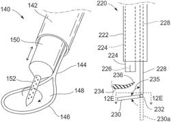 Bicuspid valve dissection device