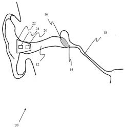 SYSTEMS AND METHODS FOR ASSESSING EAR PATHOLOGIES IN A SUBJECT