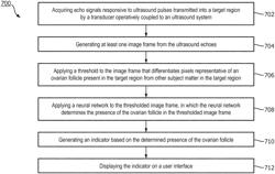 Intelligent ultrasound-based fertility monitoring