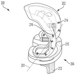 Implant With Sensor Diagnostics