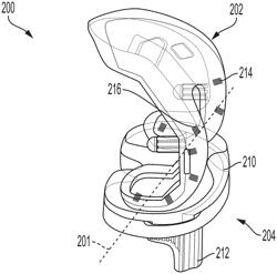 Implant Detachment Detection