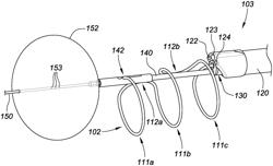 Systems, devices, and methods for the accurate deployment and imaging of an implant in the prostatic urethra