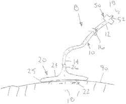 FLOW DISTRIBUTION PAD AND METHODS FOR USING THEM