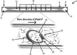 RHEOTAXIS-BASED SEPARATION OF MOTILE SPERM AND BACTERIA USING A MICROFLUIDIC CORRAL SYSTEM