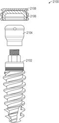 Fixed hybrid dental attachment assembly and methods of use