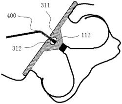 PLUGGING DEVICE