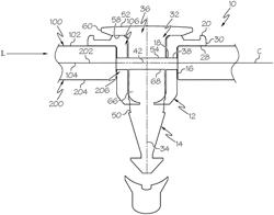 Coupling Assemblies Having Frangible Portions