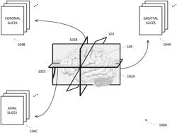 System and method for facilitating DBS electrode trajectory planning