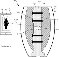 A SYSTEM FOR MONITORING A PATIENT