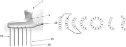 RADIO FREQUENCY ABLATION SYSTEMS