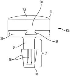 PARTIAL JOINT RESURFACING IMPLANT, INSTRUMENTATION, AND METHOD