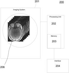 METHOD AND SYSTEM FOR AUTOMATED CENTRAL VEIN SIGN ASSESSMENT