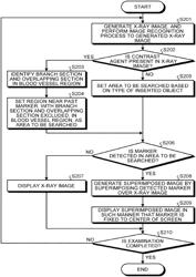 X-ray diagnostic apparatus, marker detecting method, and computer-readable non-transitory recording medium