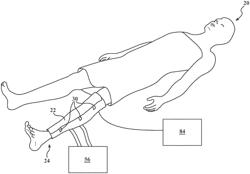 Magnetorheological elastomer and magnetorheological fluid for clinical wrap