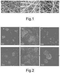 Electrospun nanofibers and membrane