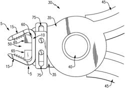 Devices for generating and applying compression within a body