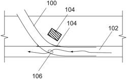 DISTAL LIMB PERFUSION CANNULA STENT & STENT CANNULA COVER