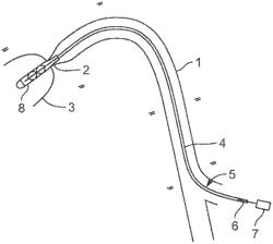 PUMP HOUSING WITH AN INTERIOR FOR ACCOMMODATING A PUMP ROTOR