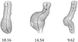 AORTIC ANEURYSM GROWTH RATE PREDICTION FROM GEOMETRIC ANALYSIS