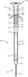 Spinal implant system and method