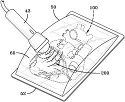 METHOD AND DEVICE TO PRESERVE ORGANS AND TISSUE FOR TRANSPLANTATION