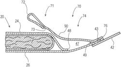 Absorbent article with waist gasketing element and leg cuffs