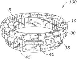 IMPLANT FABRICATION USING THREE-DIMENSIONAL WOVEN FABRIC