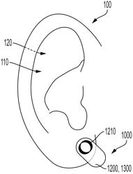 DEVICES AND METHODS FOR STIMULATING AN AURICULAR BRANCH OF A VAGUS NERVE