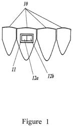 Method and apparatus for preventing plaque, calculus, and hard deposits in body cavities and the mouth