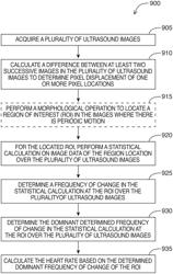 Systems and methods for determining a heart rate of an imaged heart in an ultrasound image feed