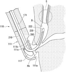 STENT DELIVERY SYSTEM AND STENT DELIVERY METHOD