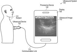 METHOD AND SYSTEM FOR MANAGING ULTRASOUND OPERATIONS USING MACHINE LEARNING AND/OR NON-GUI INTERACTIONS