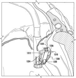 DEVICES, SYSTEMS, AND METHODS FOR DEPLOYING AN IMPLANTABLE CLIP