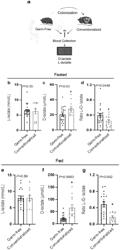 Compositions to Modify Intestinal Nutrient Absorption, Methods of Making and Uses Thereof