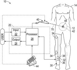 Intraoperative neural monitoring method utilizing wavelet-based event detection