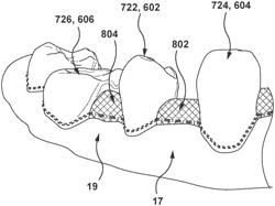 Systems and methods for forming dental appliances