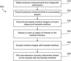 Bedside interface for percutaneous coronary intervention planning