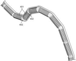 SEGMENTED BALLOON-EXPANDABLE STENT SYSTEM FOR PRESERVATION OF THE ARTERIAL LUMEN DURING BENDING