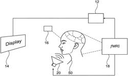 METHOD AND SYSTEM FOR PERSONALIZED ATTENTION BIAS MODIFICATION TREATMENT BY MEANS OF NEUROFEEDBACK MONITORING