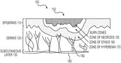 Perfusion and oxygenation measurement