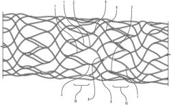 Bidirectional stent and method of use thereof