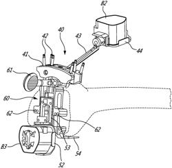 Computer-assisted surgery system and method for orienting a knee implant