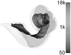 Patient-customized electrode arrays based on patient-specific cochlear information, and designing/selecting methods and applications of same