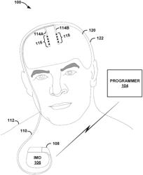 Determining relative phase relationships for delivery of electrical stimulation therapy