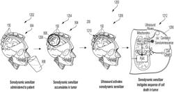 Methods of using ultrasound waves for sonodynamic therapy