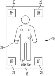 ESTIMATION OF BLOOD PRESSURE USING BALLISTOCARDIOGRAM AND PERIPHERAL PHOTOPLETHYSMOGRAM