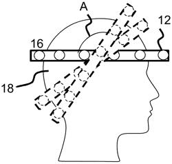 Method of, and apparatus for, non-invasive medical imaging using waveform inversion